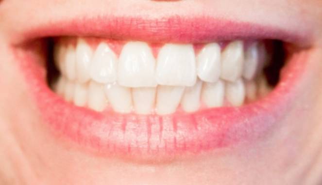 Efek Dari Penggunaan Pemutih Gigi Instan Akan Buat Anda Menyesal